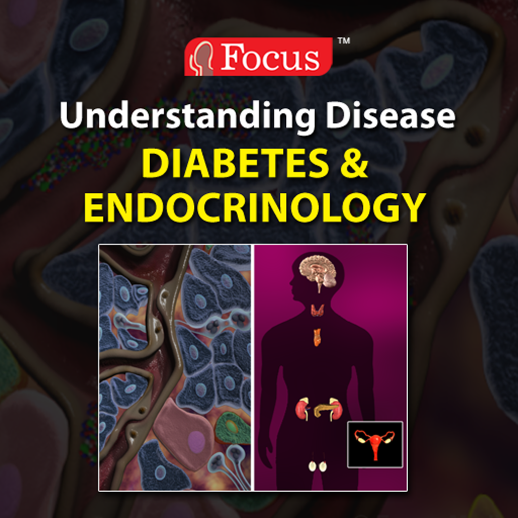 Diabetes & Endocrinology (Understanding Disease Series) by Expanded